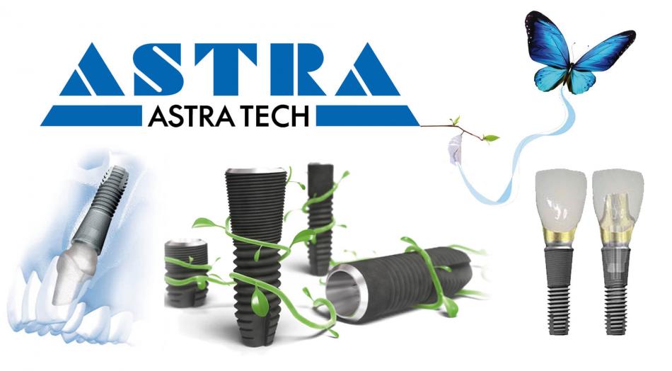 Шведские импланты Astra Tech (Астра Тек).