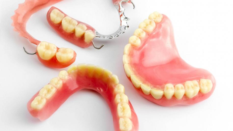Виды протезирования зубного ряда.