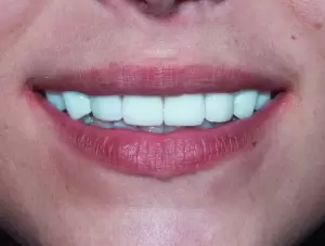 Фотография Смайлик 5