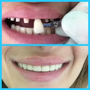 Фотография Статус 4